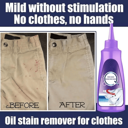 🔥Active Enzyme Laundry Stain Remover - ✨White Shirt Guardian