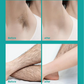 🌟LAST DAY SALE: ONLY ￡9.99!!🎁✨Painless Full Body Hair Removal Cream for Men & Women– Skin-friendly for all areas🌿