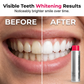 🌸  Stain‑Removing Whitening Mouthwash – Deep Clean Stains, Brighten Teeth & Freshen Breath Instantly ✨